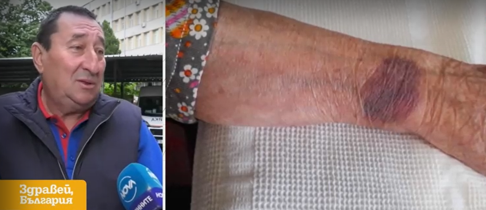 Лечение във Видин: В болницата връзвали 104-годишна жена за ръцете и краката